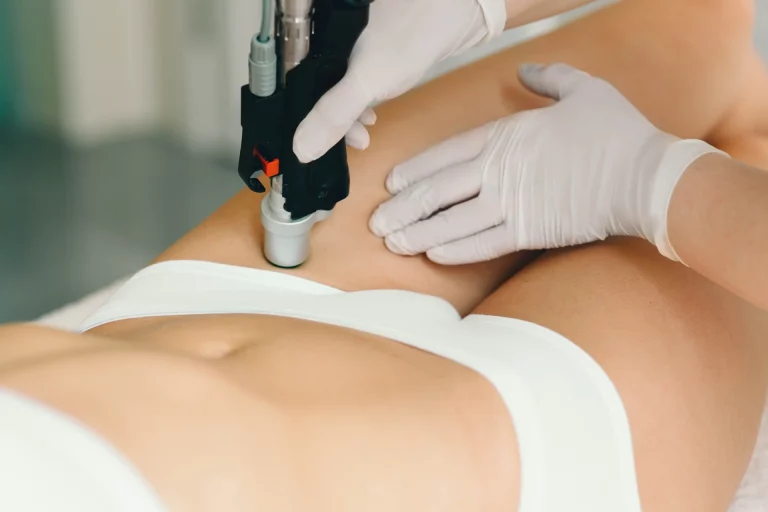 The Complete Guide to Brazilian Laser Hair Removal: Everything You Need to Know